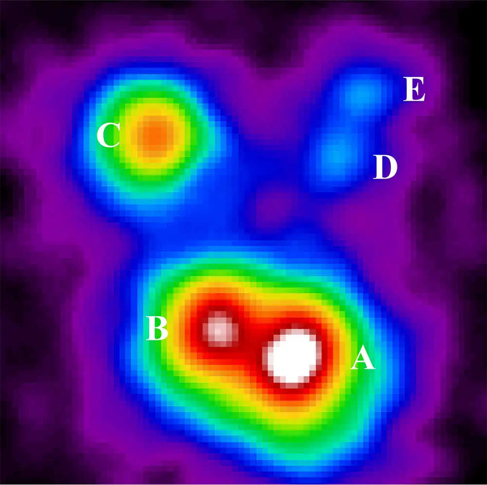 X-ray observation of multiple quasar images