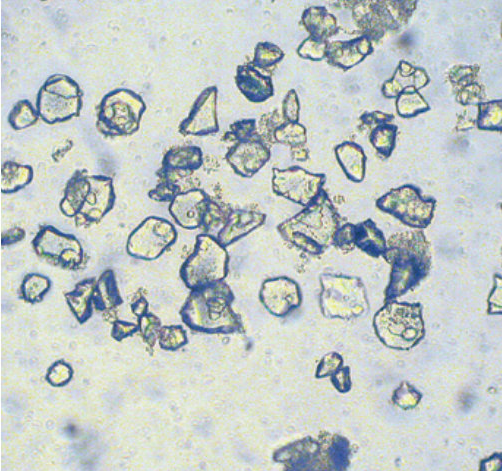 Aluminum oxide grit particles | Sky & Telescope